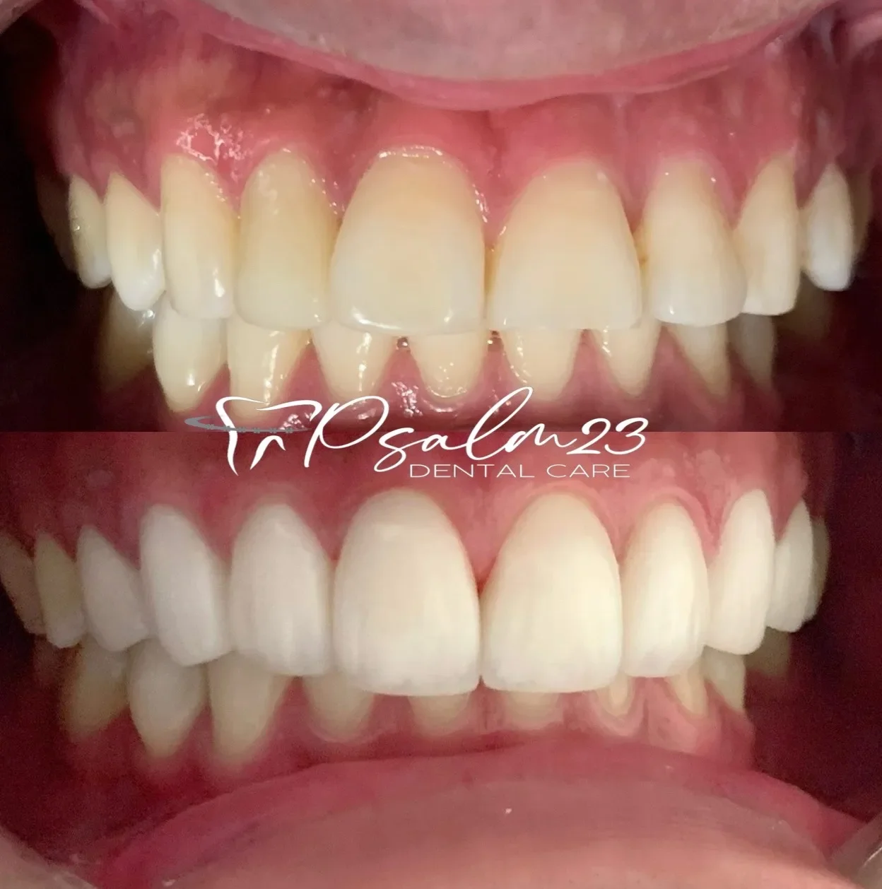 Psalm23 Dental Care cosmetic dentistry services — photo 1
